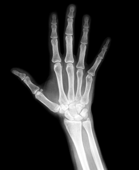 xray images